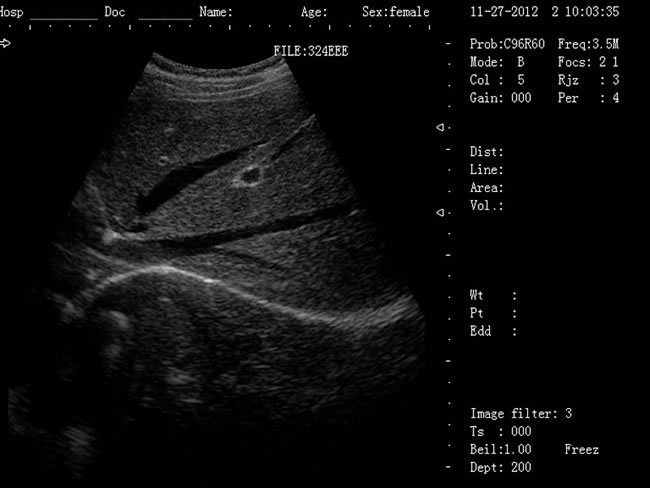 老式的b超機(jī)黑白要多少錢,新型B超機(jī),B超機(jī),黑白B超機(jī)
