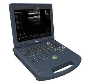 筆記本式全數(shù)字彩色多普勒超聲診斷儀