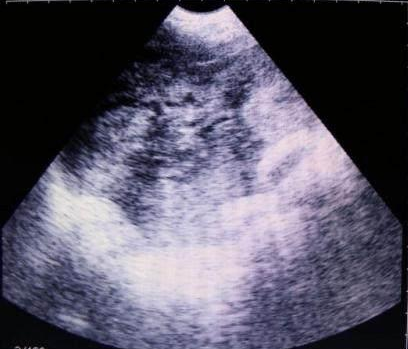 母豬B超檢測(cè)空懷圖片