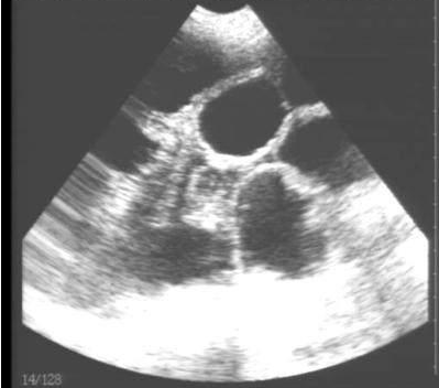獸用B超機(jī)檢測(cè)母豬有胎兒圖像